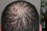 hair