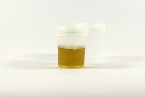 urine in test container